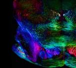 Spatially oriented neurons (mouse brain)